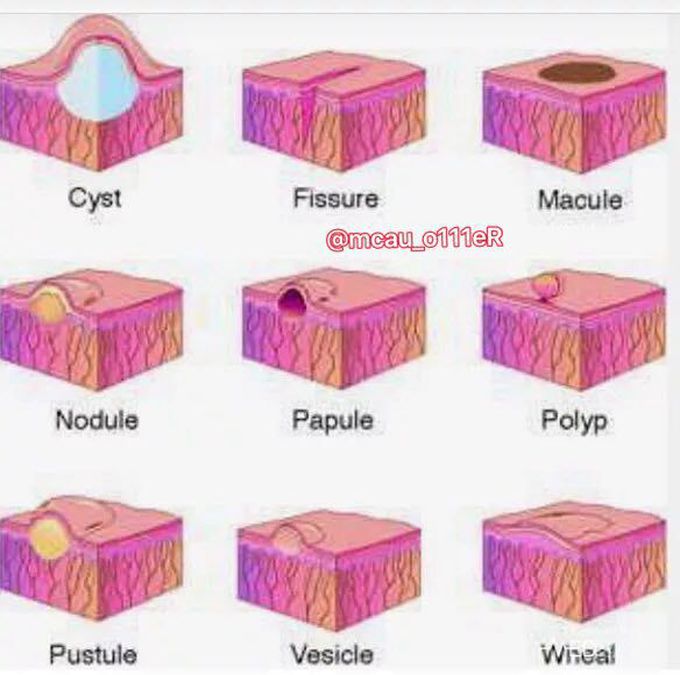 Must know