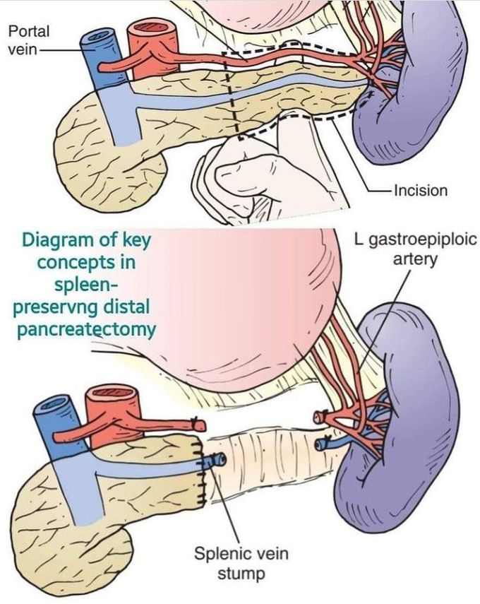 General surgery MEDizzy
