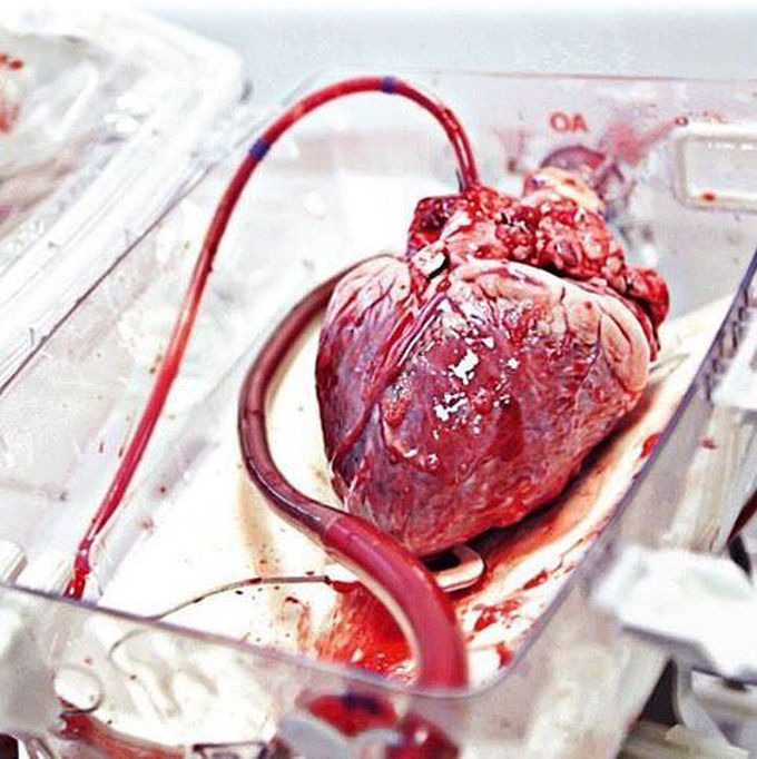 Human Heart, ready to be transplanted
