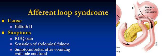 These are the symptoms of Afferent loop syndrome