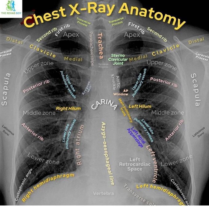 Chest Xray Anatomy MEDizzy