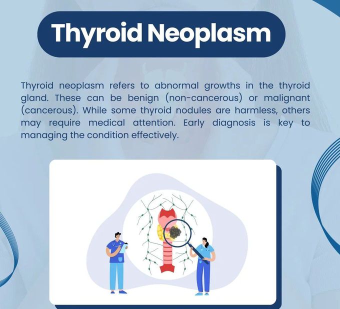 Thyroid Neoplasm