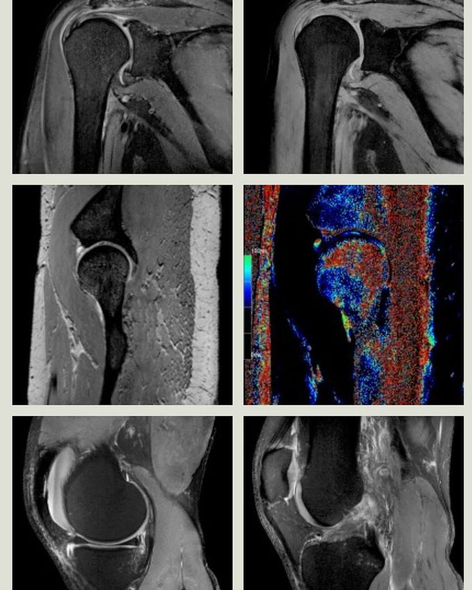 MSK MRI at 7 Tesla!