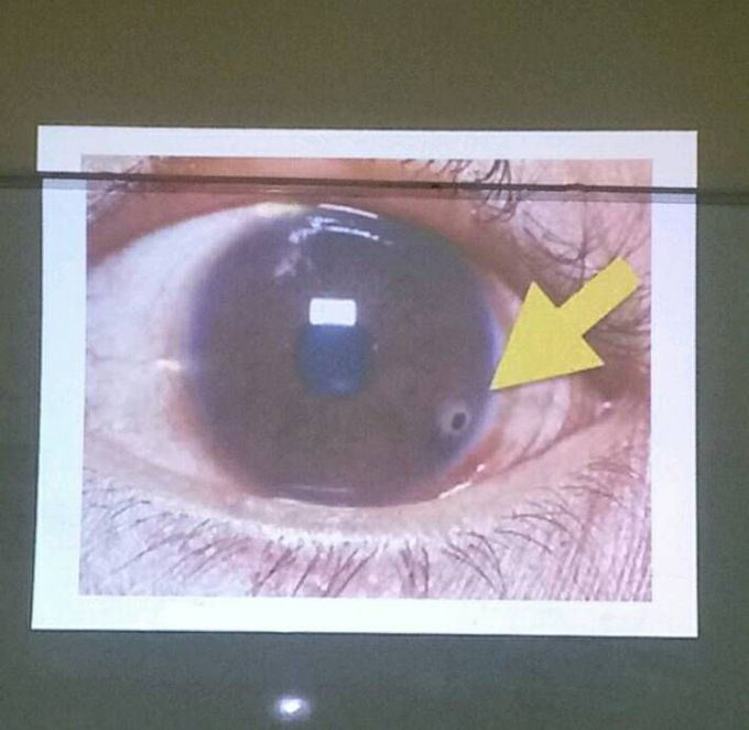 Diagnosis ?????