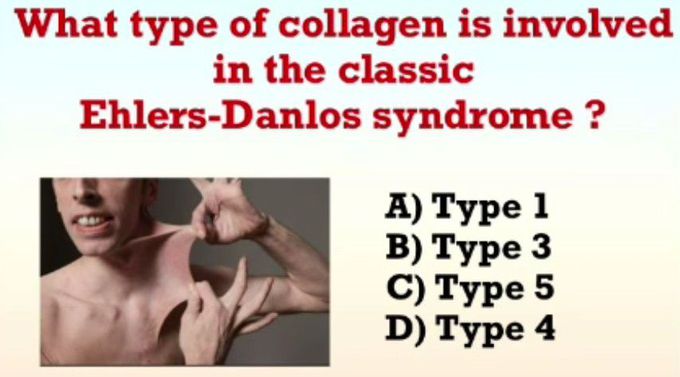 Ehlers-Danlos Syndrome