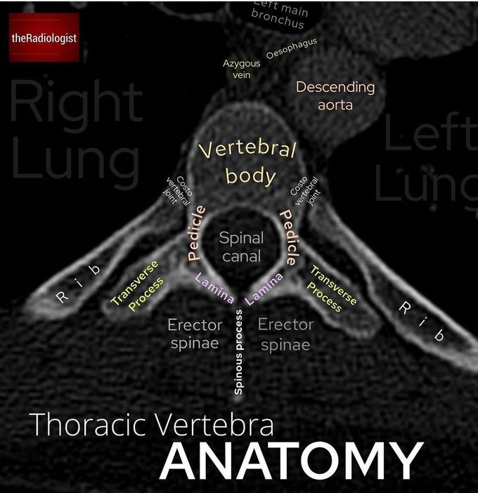 Thoracic vertebra