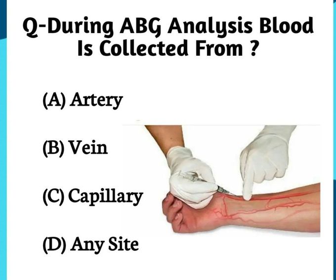 ABG Analysis