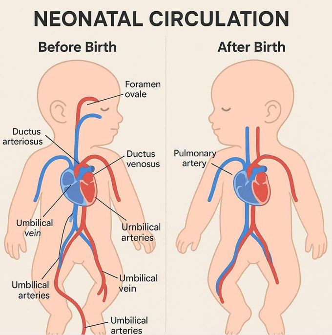 Neonatal Circulation