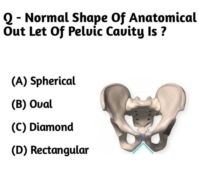 Identify the Shape