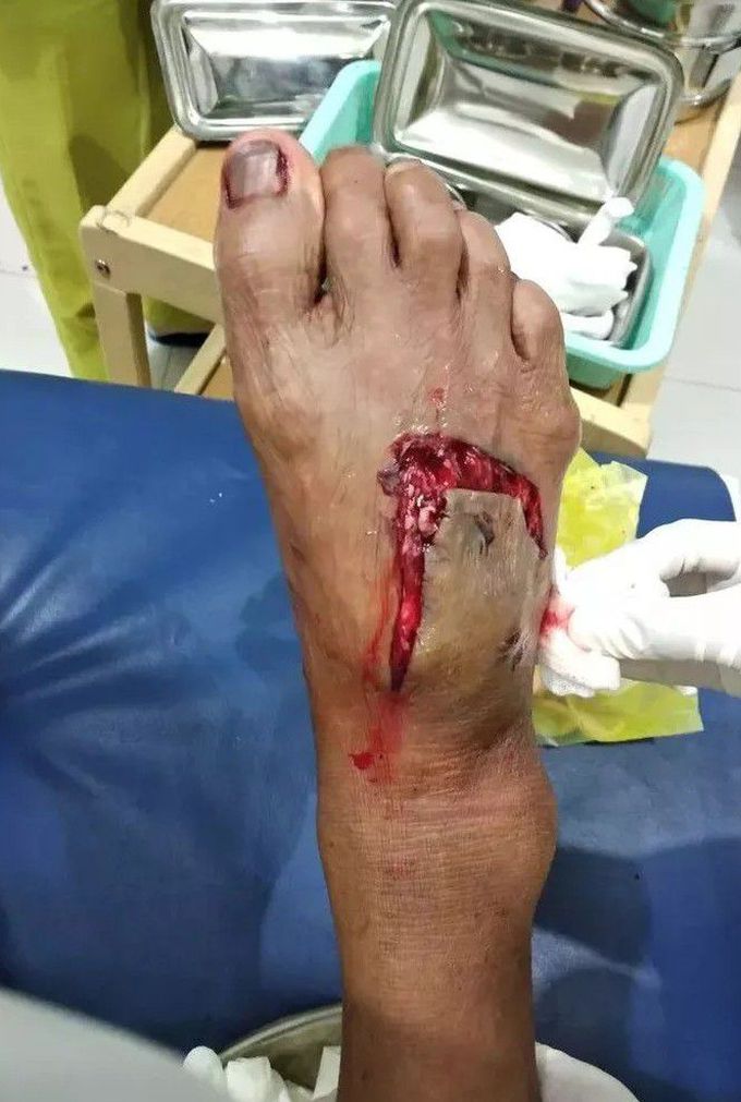 orthopedic surgery