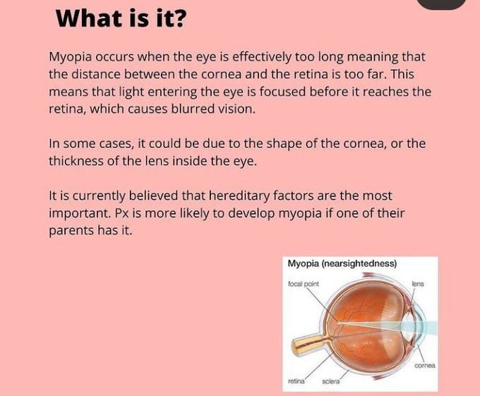 What is myopia?