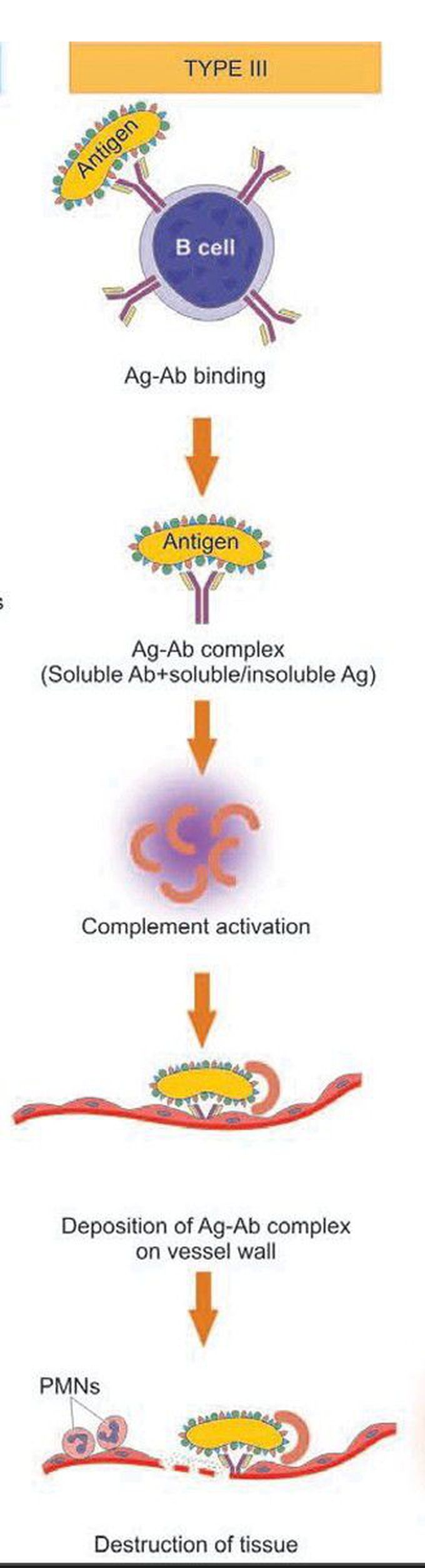 Type 2 hypersensitivity