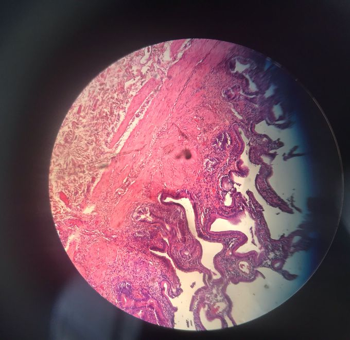 Gallbladder cell
