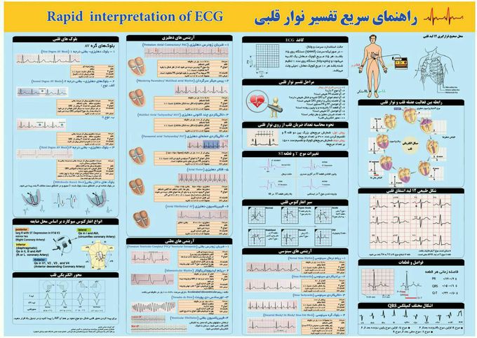 ECG,tip,study rapid chart