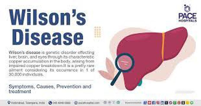 Wilson's disease