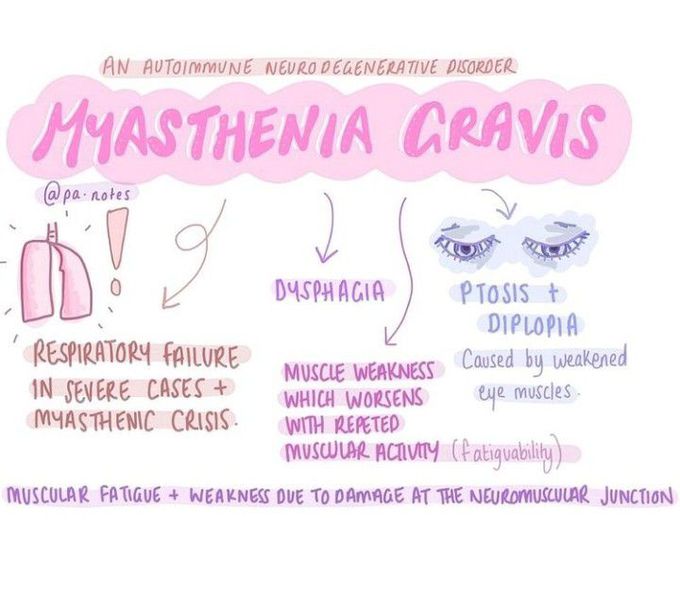 Myasthenia Gravis