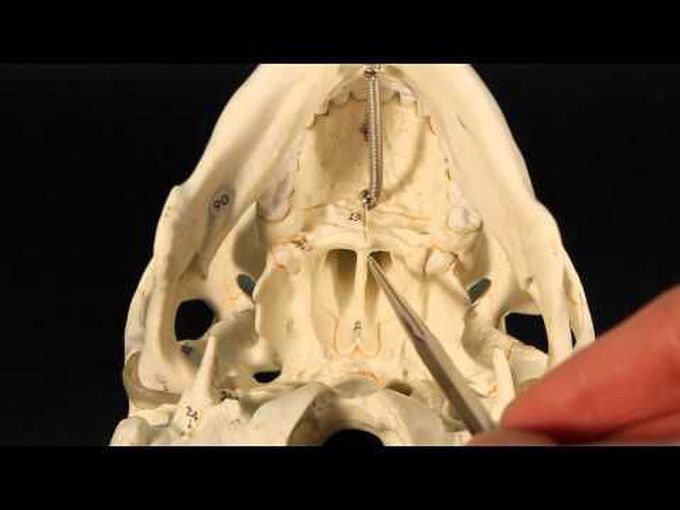 Anatomy of the Facial bones