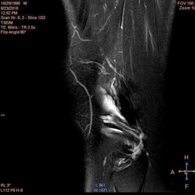 Diagnostic?