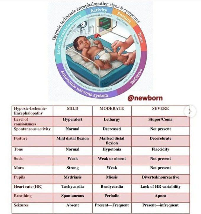 Hypoxic ischemic encephalopathy