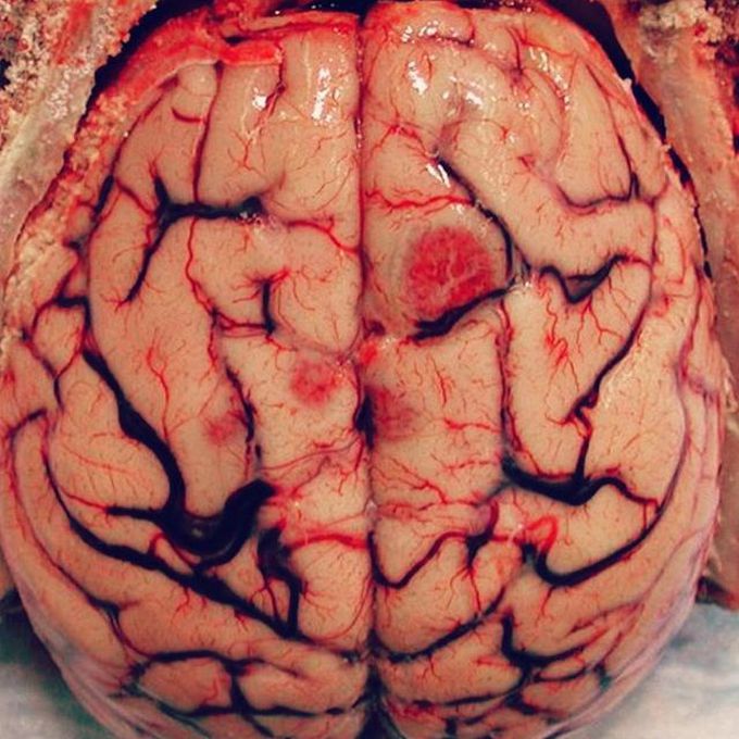 Incredible view of the human brain