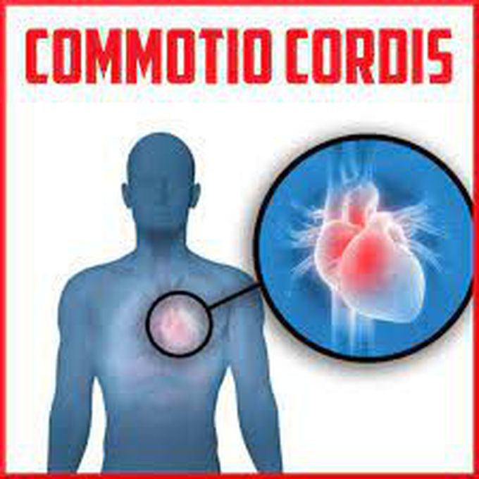 What is commotio cordis?