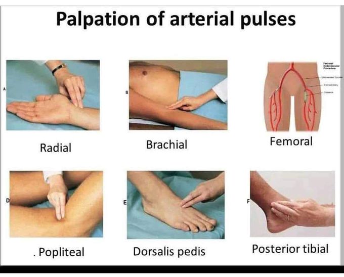 Palpation of arterial pulses