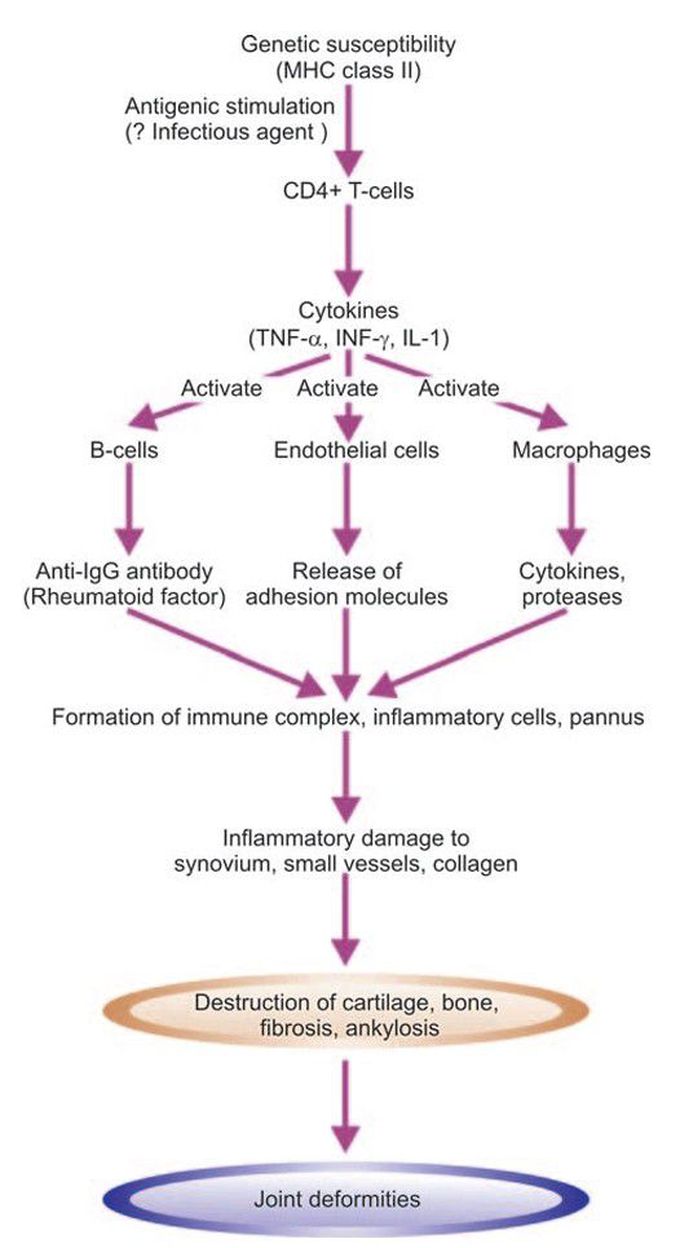 Rheumatoid arthritis