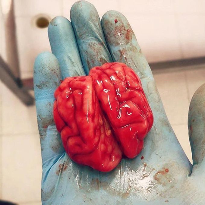 Have you ever seen a brain this size?