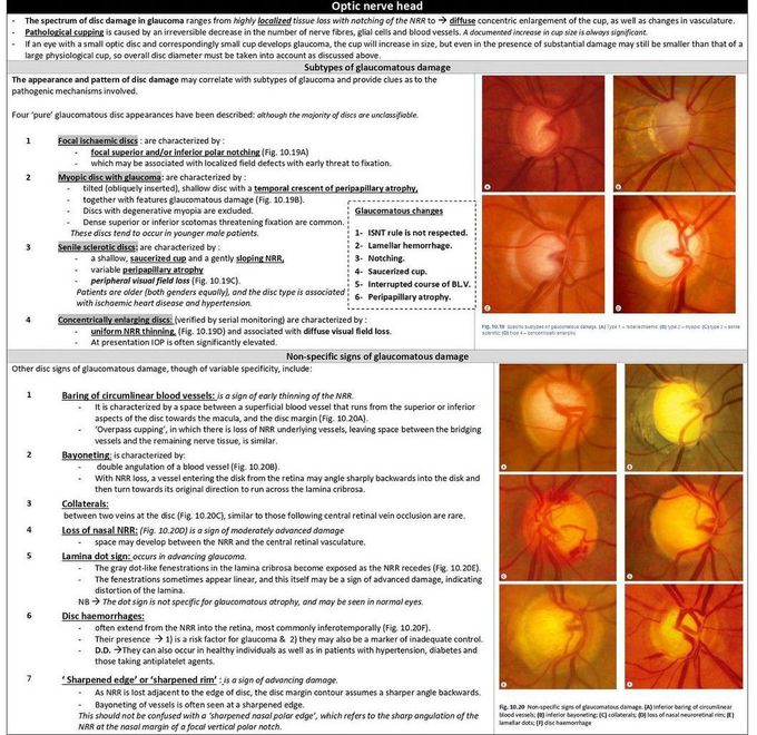 Optic Nerve Head