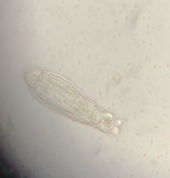 Can you gues what is this parasite ?