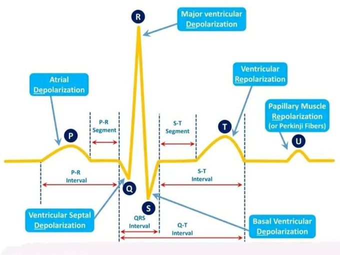 ECG basics...