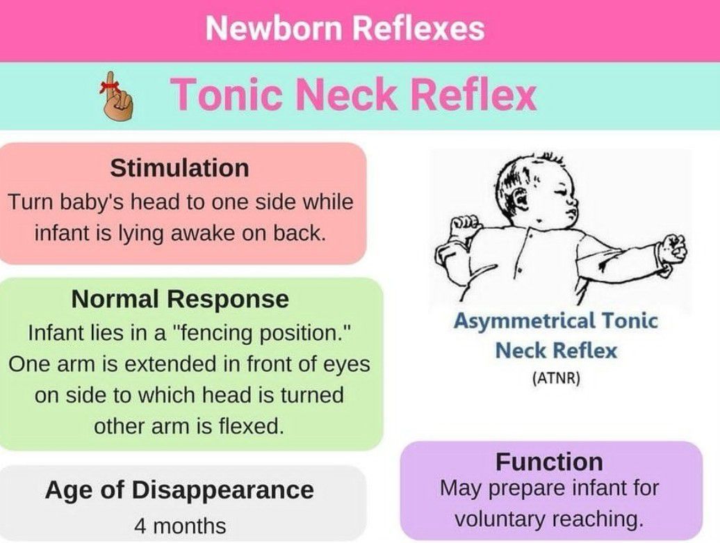 tonic-neck-reflex-medizzy