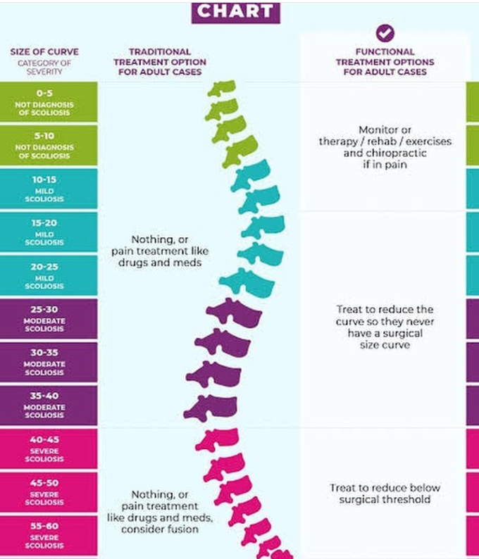 Scoliosis