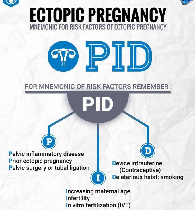 Ectopic Pregnancy