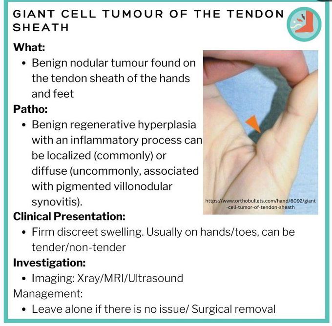 Giant Cell Tumor