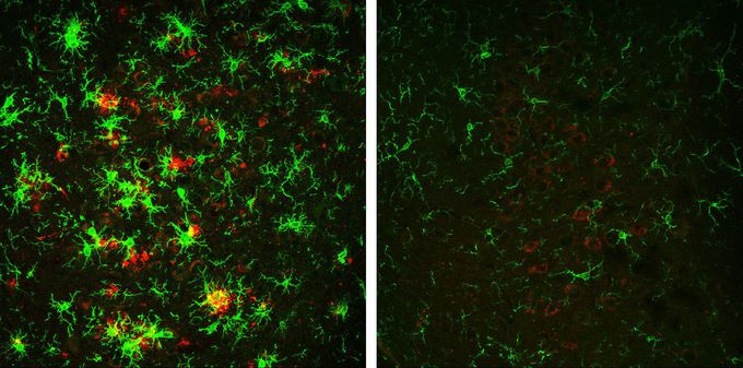Researchers successfully reverse Alzheimer's disease in mouse model