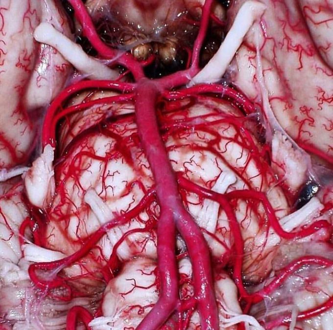 Circle of willis 