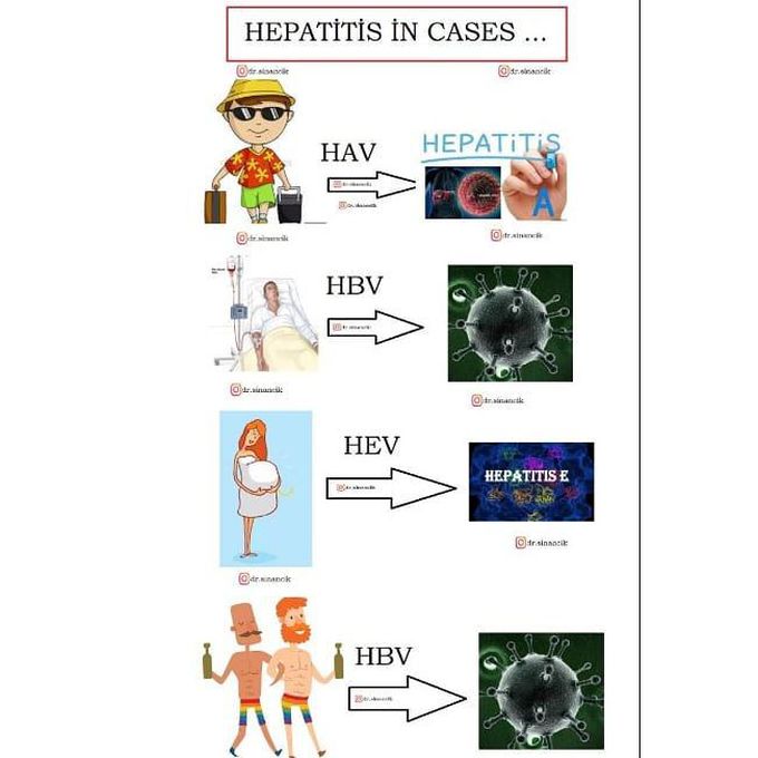 Hepatitis