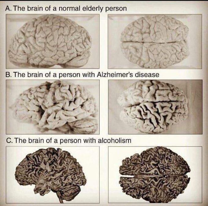 brain