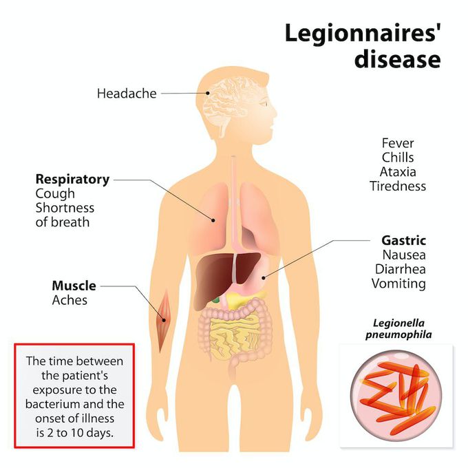 Cause of Legionnaires' disease.