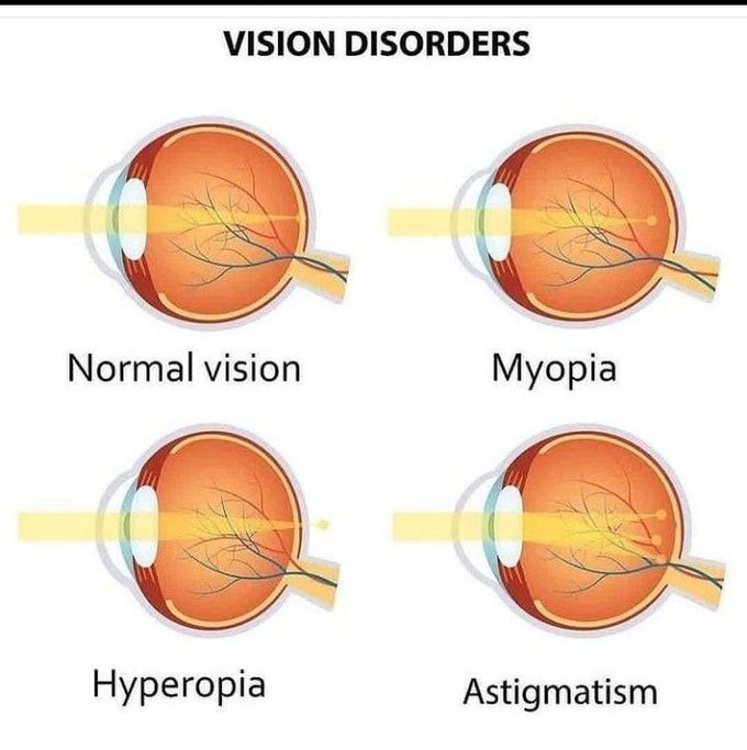 Vision disorders