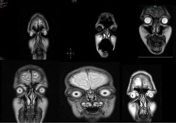 Head MRI