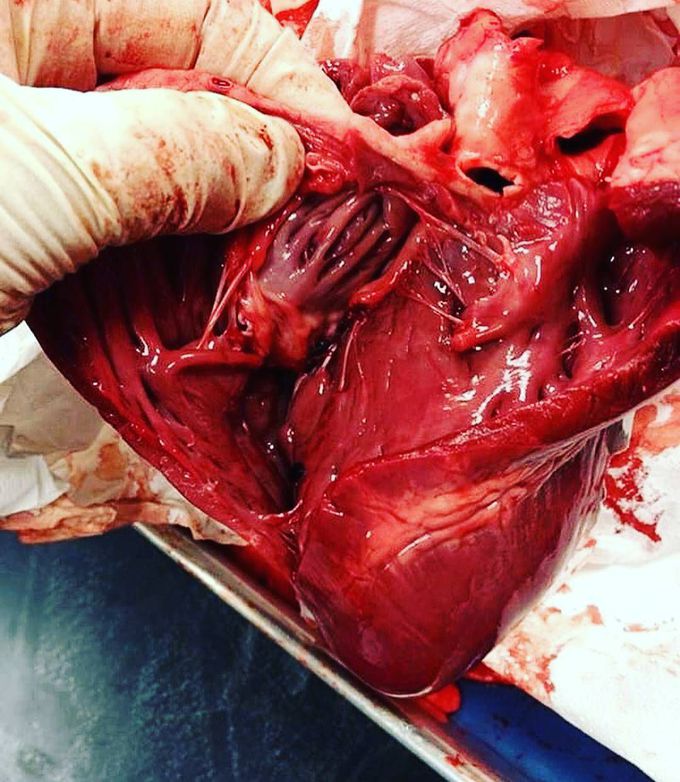 The heart