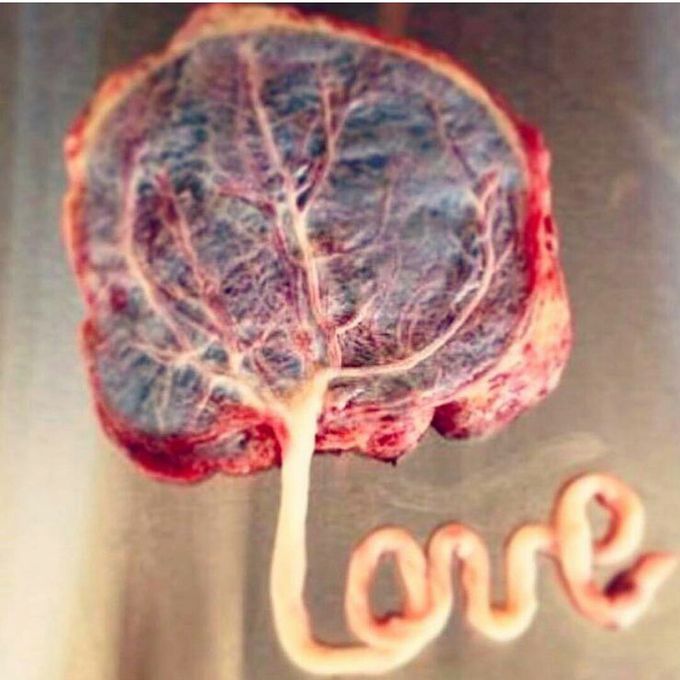 Placenta