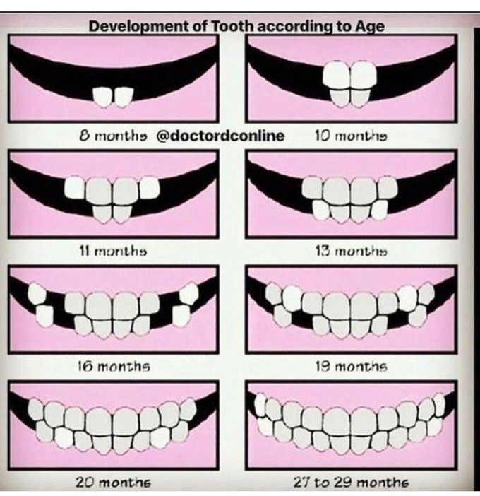 eruption-of-deciduous-teeth-medizzy