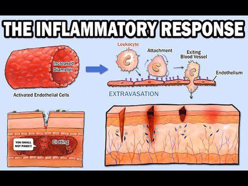 A short guide to Inflammation - MEDizzy