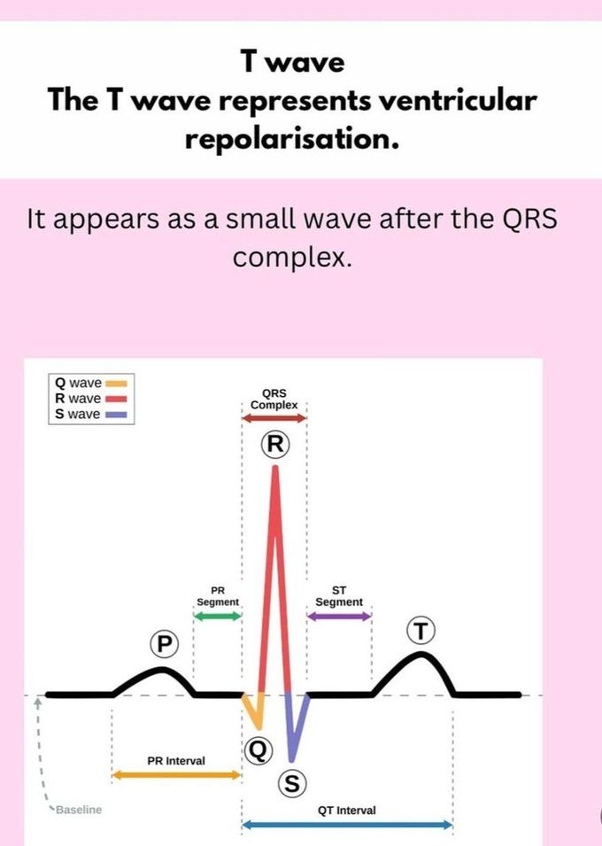 ECG Basics V