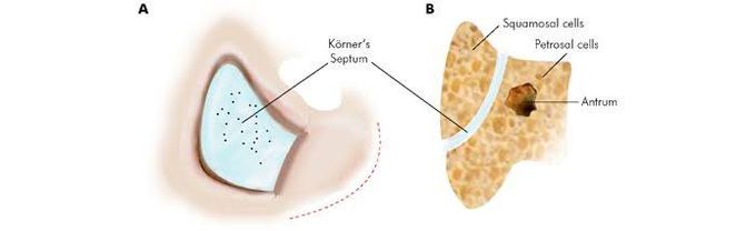 Koerner's septum