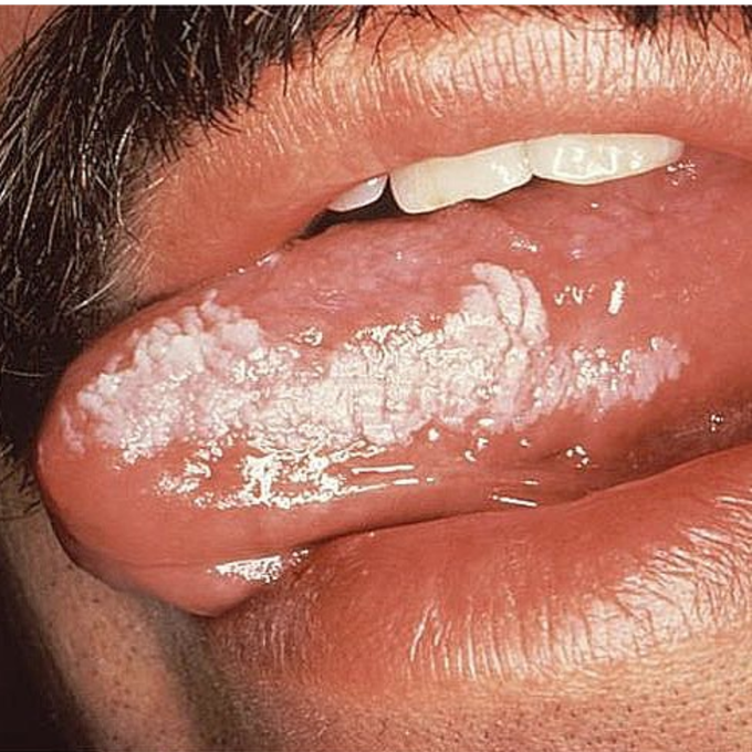 Diagnosis?
