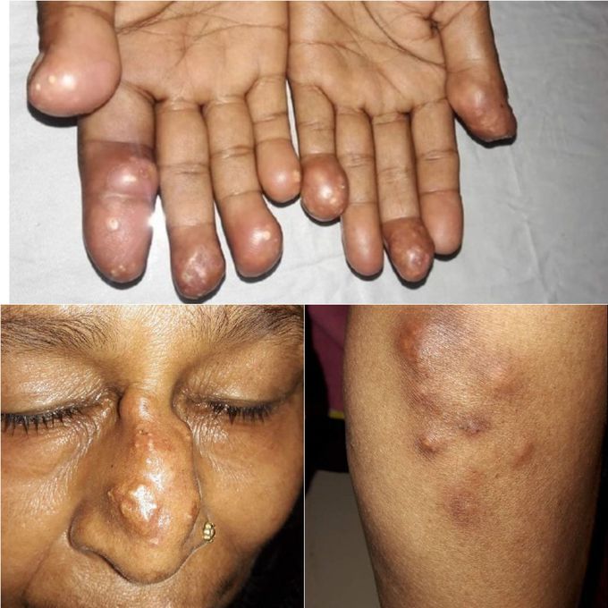Diagnosis??